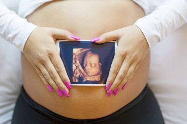 4Д УЗИ в беременность