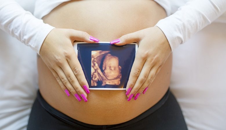 4Д УЗИ в беременность